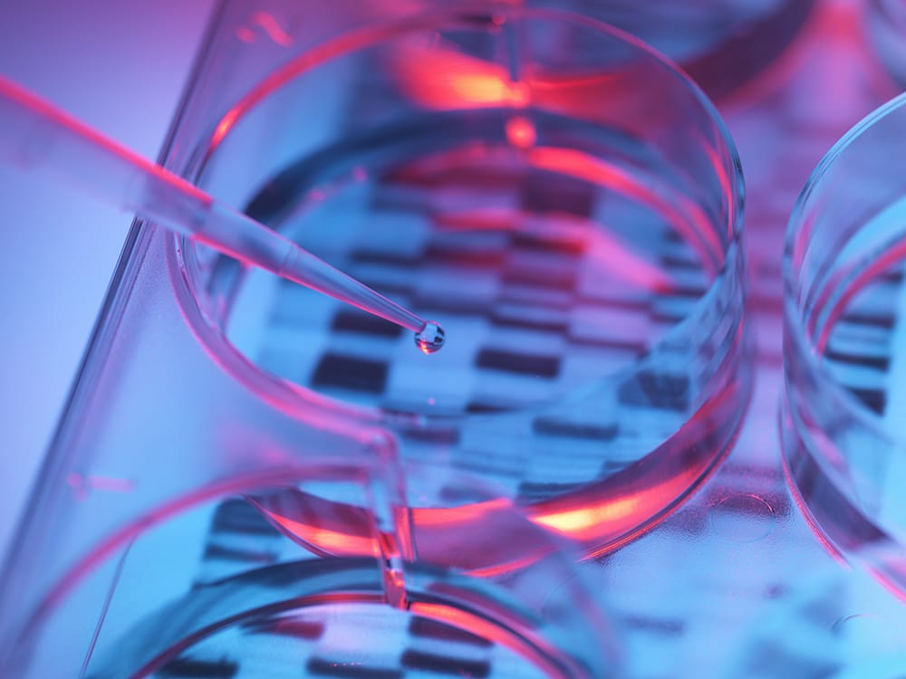 DNA testing